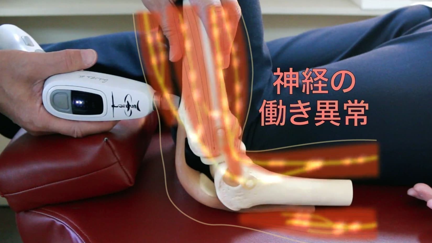膝関節の調整前｜神経と筋肉の働きが異常｜ファミリーカイロプラクティックセンター福岡